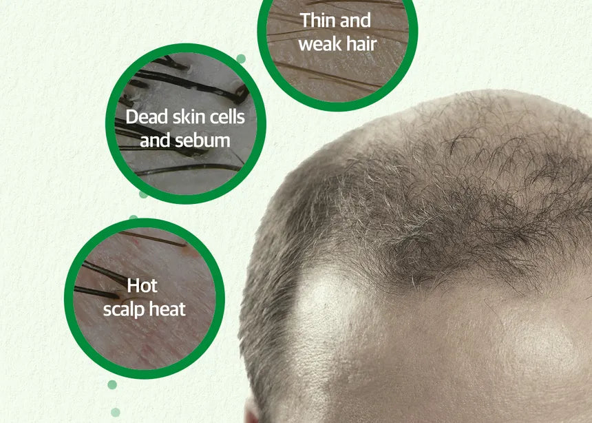 SOME BY MI Cica Peptide Anti Hair Loss Derma Scalp Set – Shampoo 285 ML + Treatment 50ML + Tonic 150ML