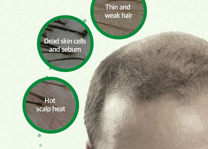SOME BY MI Cica Peptide Anti Hair Loss Derma Scalp Duo – Treatment (50ml) + Tonic (150ml)