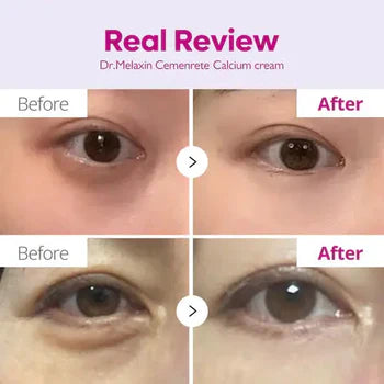 Dr.Melaxin - Cemenrete Calcium Volume Cream - 50ml
